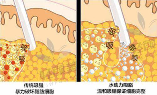 【西宁夏都医疗美容医院是正规的吗】