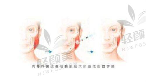 【西宁青美医疗美容医院地址及乘车路线】