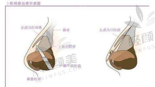 【西宁夏都医疗美容医院口碑怎么样】