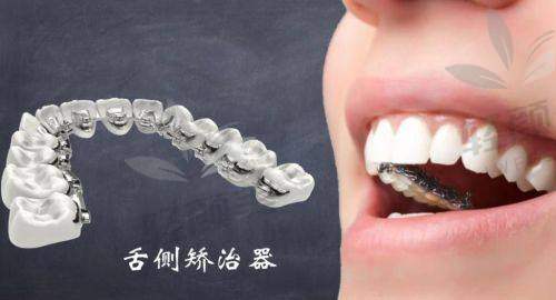 决定矫正，选择黄帅医生