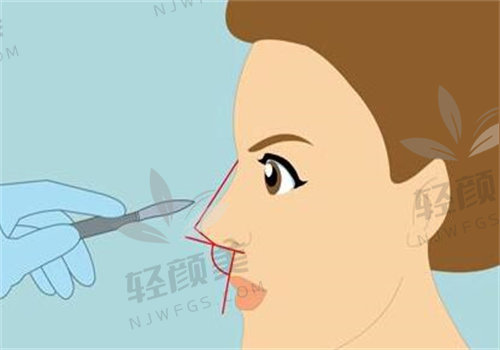 2026 鼻综合手术价格表解读：各医院医生优势及对应价格区间一目了然