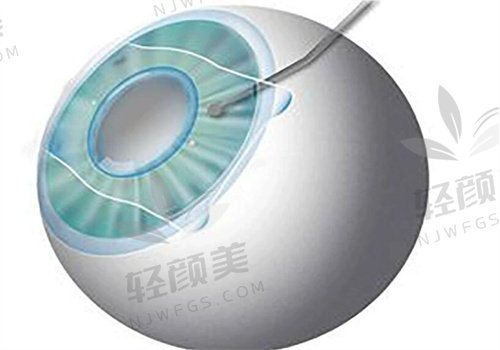 华厦眼科医院收费价格表大公开，多地不同眼科手术及项目收费全掌握！