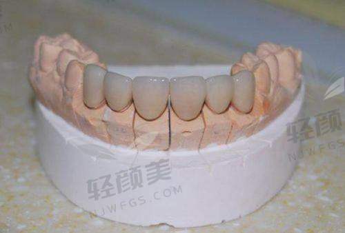 三、价格差在哪？想不被宰，先搞懂以下因素