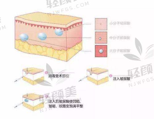 六、法思丽——“塑型控”的心头好，立体感MAX ?