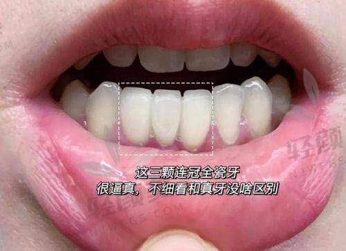 二、“四大系列”到底怎么选？来，分类讲明白！