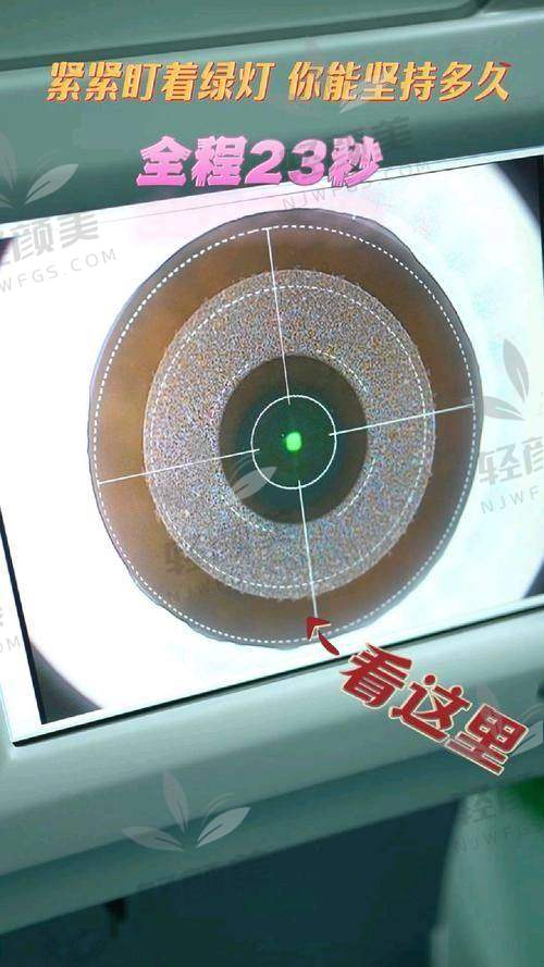 朝聚眼科全飞秒价格：性价比高，物超所值
