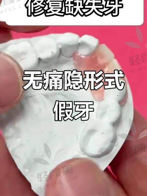 结语：2026更全活动假牙价格表出炉，这篇文章你收藏了吗？