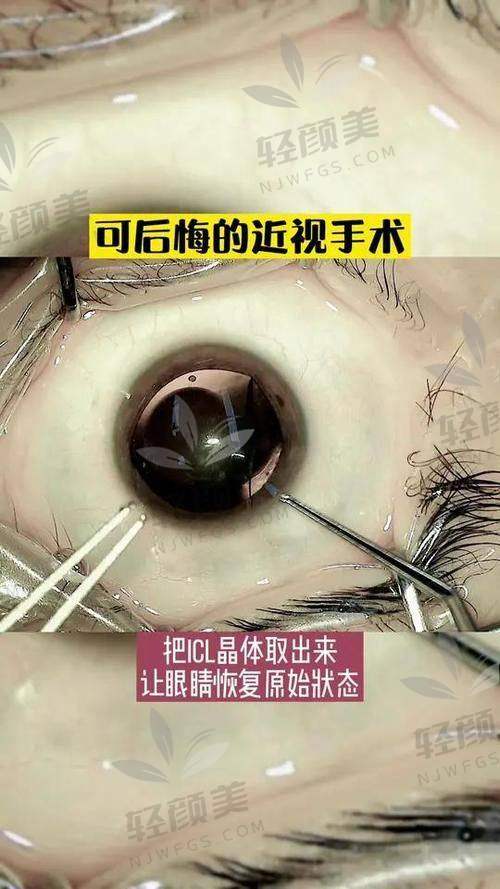 术后的修复与护理