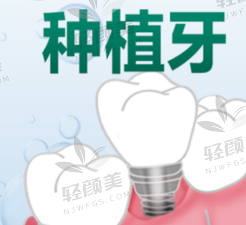 2️⃣ 瑞士SIC种植体 —— 中高端性价比王者