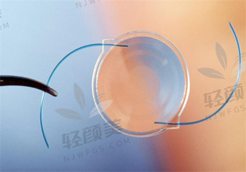 上海新视界于妍娉ICL晶体植入体验：价格实惠效果好，近视手术选这靠谱！