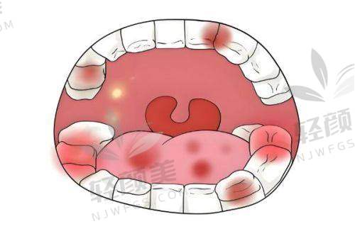【吴忠市利通区洁雅口腔门诊部地址及乘车路线】