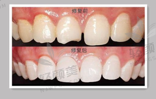 【吴忠同心张学亮口腔诊所营业时间是什么时候】