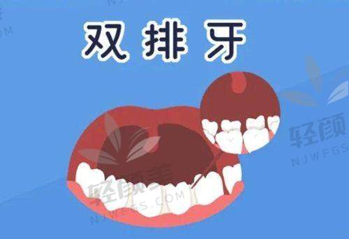 【吴忠盐池县小姬口腔门诊部擅长什么项目】