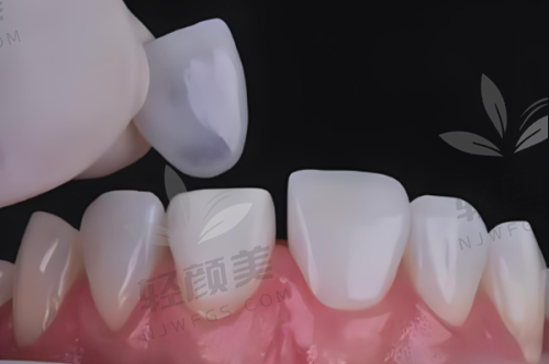 【吴忠市利通区姚学荣口腔诊所是私立还是公办】