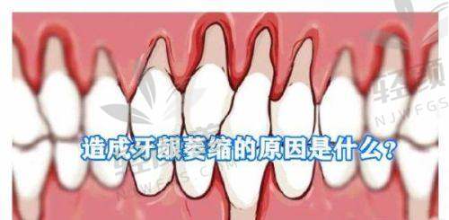 【宁夏吴忠市红寺堡区齐梅口腔门诊部擅长什么项目】