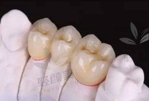 【吴忠市利通区马力口腔门诊部是正规的吗】