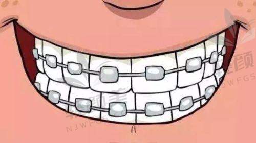 【吴忠红寺堡区雅康口腔门诊部仪器设备有哪些】