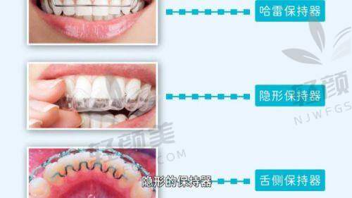 【吴忠付亚栋口腔诊所擅长什么项目】