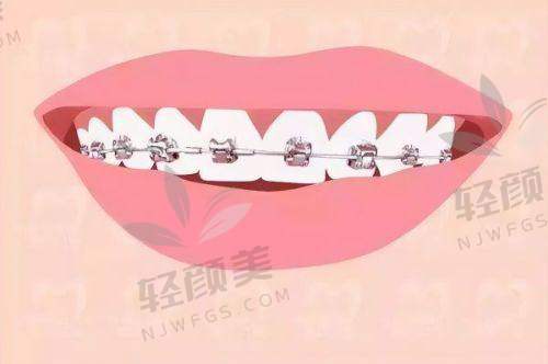 【吴忠青铜峡陈萍口腔诊所仪器设备有哪些】