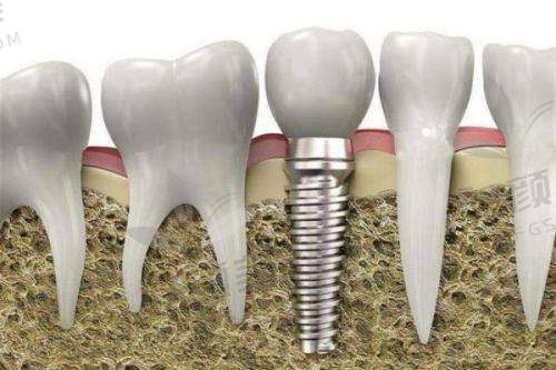 【吴忠市利通区马力口腔门诊部是私立还是公办】