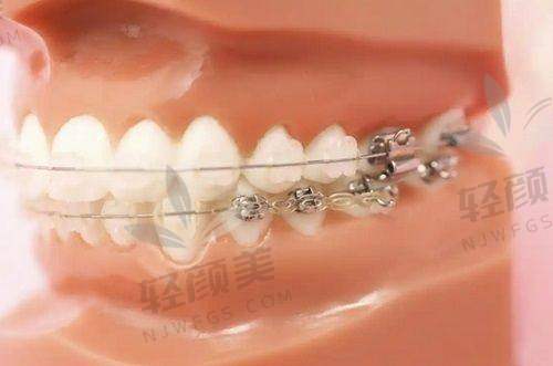 【吴忠付亚栋口腔诊所怎么预约挂号】