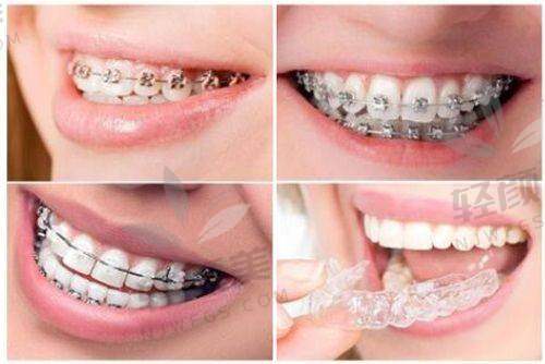 【吴忠红寺堡区雅康口腔门诊部怎么预约挂号】