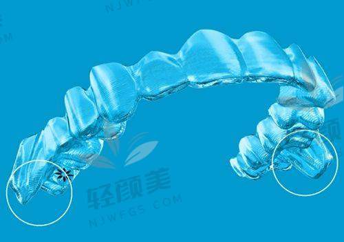 【吴忠青铜峡陈萍口腔诊所营业时间是什么时候】