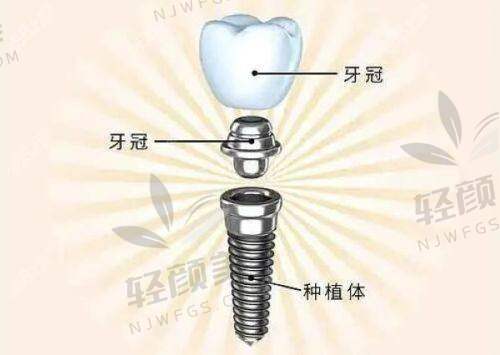 【吴忠牙美口腔诊所擅长什么项目】