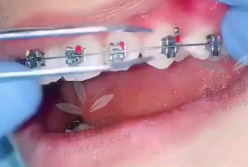 【宁夏吴忠市红寺堡区齐梅口腔门诊部地址及乘车路线】