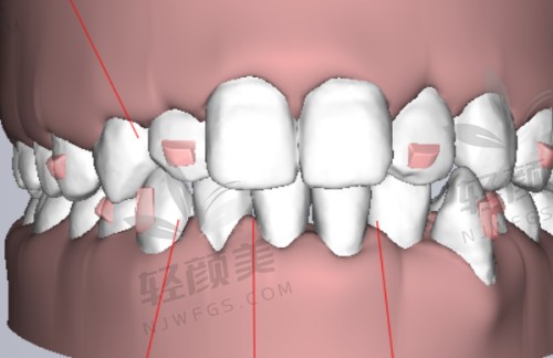【吴忠市利通区洁雅口腔门诊部是私立还是公办】