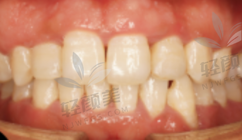 【吴忠付亚栋口腔诊所电话号码是多少】