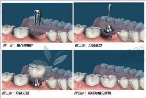 结语：总结+建议