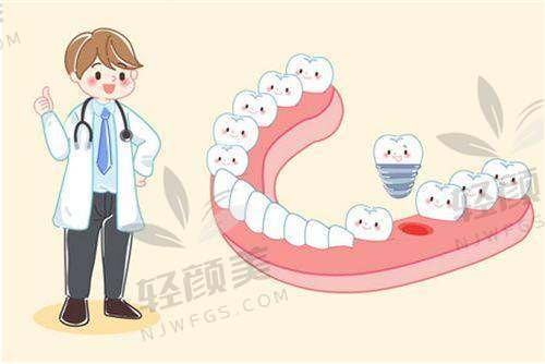 五、瑞士种植牙 VS 韩国种植体 VS 国产种植体？怎么选实在不迷糊