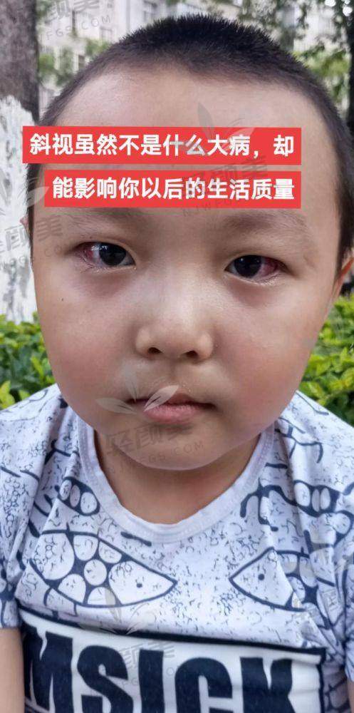 治疗：成效显著，费用合理