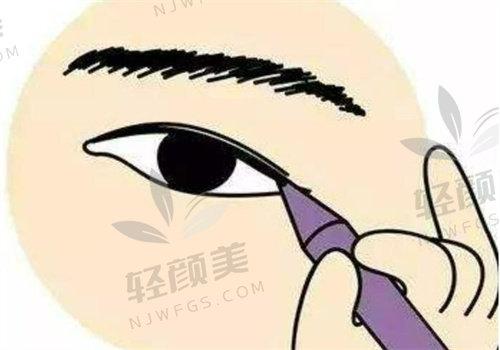 花12800在拉萨爱思特找郑波做眼周桃花熨，去皮开眼角，效果惊艳似换脸！