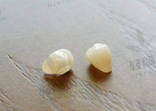 德国全瓷牙冠十大排名出炉，各品牌特点、适用场景与价格全解析！