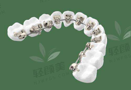 初次面诊：专精又贴心