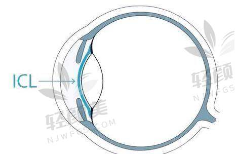 四、MF30适合谁?近视+老花+远光,体验派选它没错