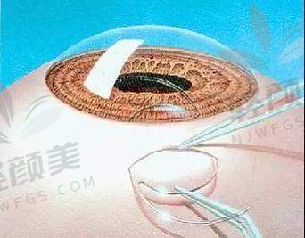 五、价格差别大,结果也配得上吗?看用户真实体验