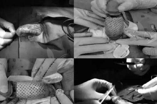 【兰州梦怡美医疗美容诊所地址及乘车路线】