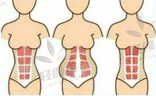 【兰州星河美汇医疗美容医院擅长什么项目】