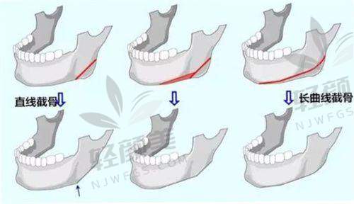 【兰州星河美汇医疗美容医院是私立还是公办】