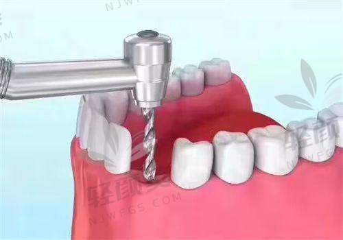 四、价格与质量优势