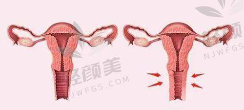 【兰州华美医疗美容医院是正规的吗】