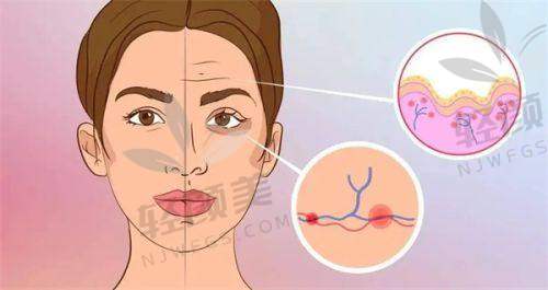 【兰州华美医疗美容医院口碑怎么样】