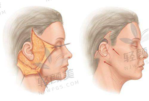 【兰州华美医疗美容医院怎么预约挂号】