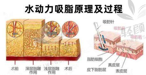 【兰州仁和医疗美容医院电话号码是多少】