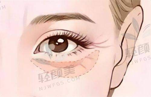 【兰州仁和医疗美容医院口碑怎么样】