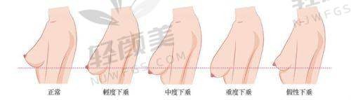 【兰州市崔大夫博士丽医疗美容门诊部口碑怎么样】