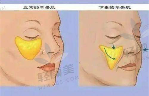 【兰州华美医疗美容医院地址及乘车路线】